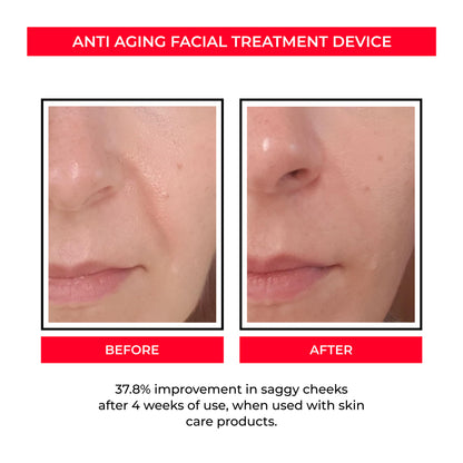 Before and after close-up of facial skin showing reduced saggy cheeks after anti aging treatment