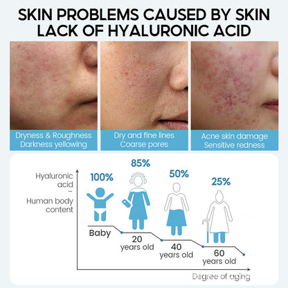 Close-up images showing skin problems from lack of hyaluronic acid: dryness, roughness, fine lines, acne redness, with aging graph