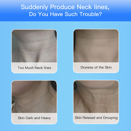 Four close-up images showing neck skin issues: excessive neck lines, dry skin, dark heavy skin, and relaxed drooping skin on blue background