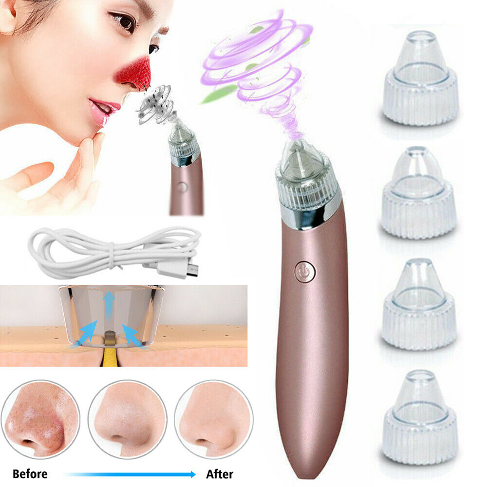 Electric blackhead remover device with four suction heads, USB charger, and nose pore cleaning before and after results