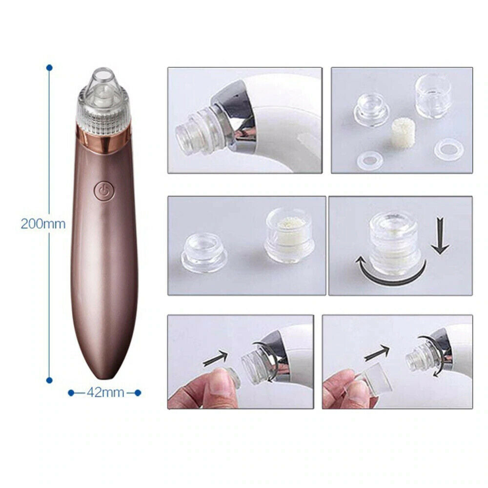 Electric blackhead remover with detachable suction heads and filter, 200mm length and 42mm width