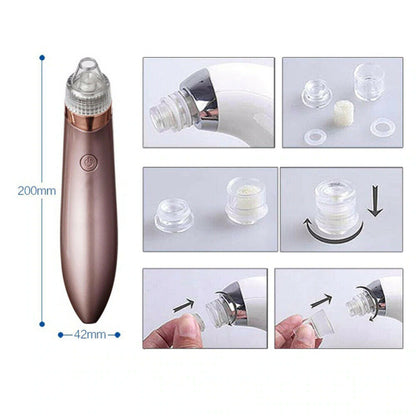 Electric blackhead remover with detachable suction heads and filter, 200mm length and 42mm width