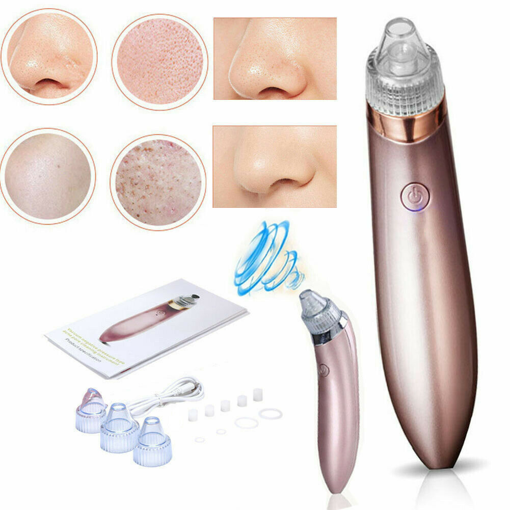 Trendoligy electric blackhead remover with suction heads and before after nose pore cleaning results