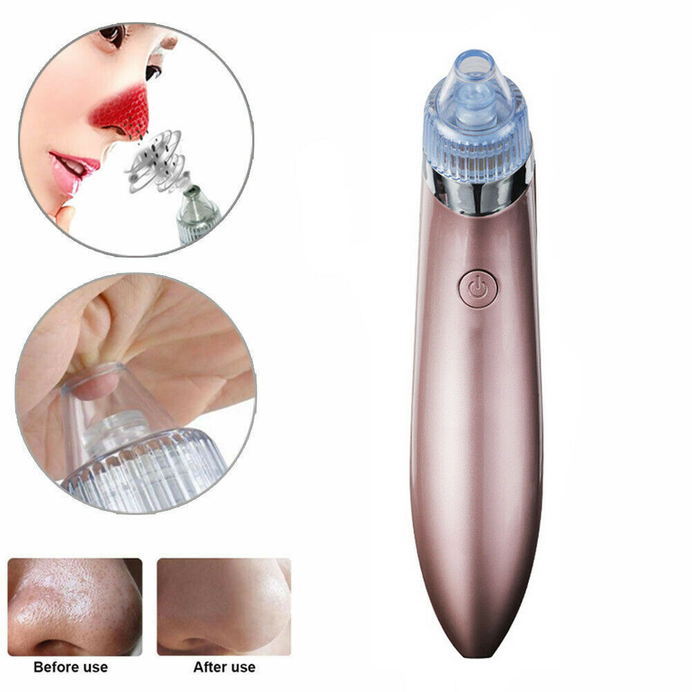 Rose gold electric blackhead remover with suction tip, close-ups showing pore cleaning and before-after nose results